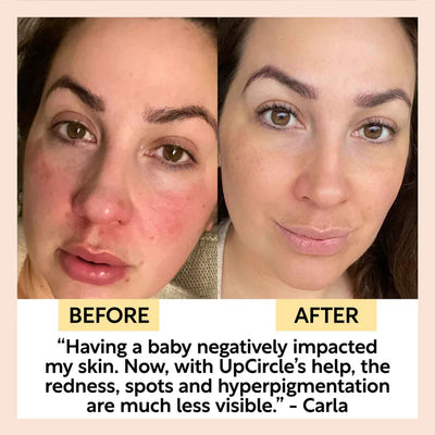 UpCircle Beauty 透明質酸咖啡因緊緻眼霜及精華油套裝