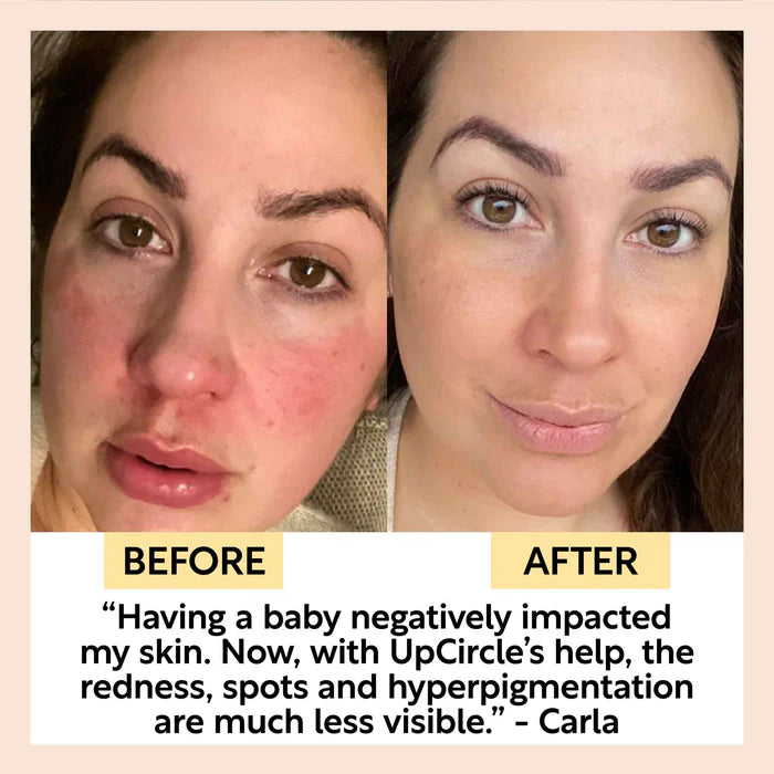 UpCircle Beauty 透明質酸咖啡因緊緻眼霜及精華油套裝