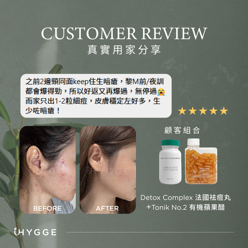 Days of Confidence 法國袪痘丸 60粒 (高效排毒│腸道健康)