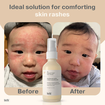 Birth Skincare 嬰兒燕麥草本護膚精華