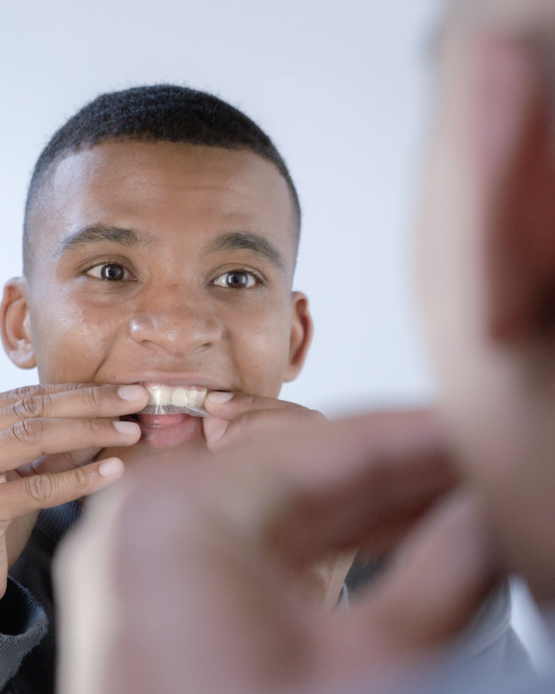 Alpine White Whitening Strips